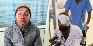 ਔਰੰਗਜ਼ੇਬ ਦੇ ਪੈਰੋਕਾਰਾਂ ਵਲੋਂ ਕੀਤੇ ਹਮਲੇ ਵਿੱਚ ਜ਼ਖਮੀ ਹੋਏ ਸਿੱਖ ਨੌਜਵਾਨ ਦੀ ਇੱਕ ਅੱਖ ਦੀ ਰੌਸ਼ਨੀ ਜਾਂਦੀ ਰਹੀ Sikh Boy Attack News